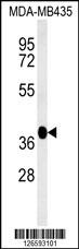 FBXL14 Antibody