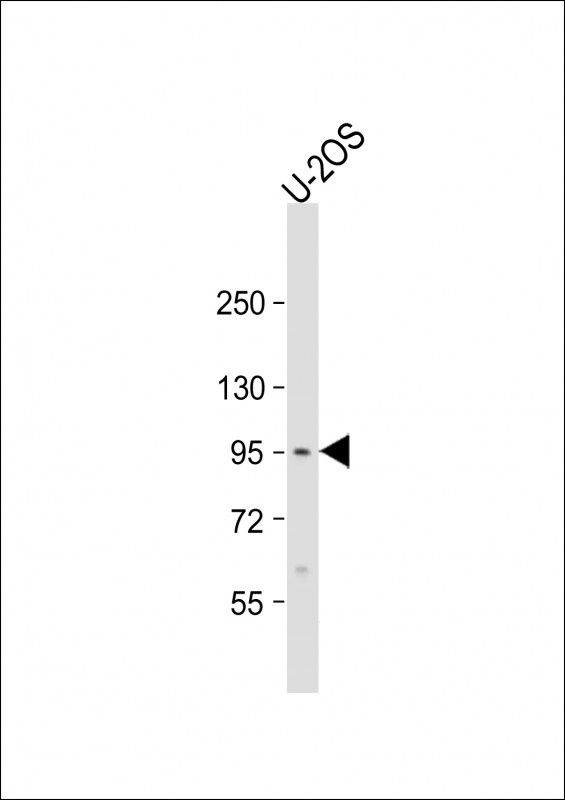 EPC2 Antibody