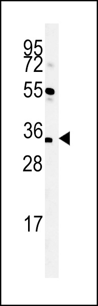 SPATC1L Antibody