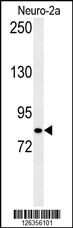 HID1 Antibody