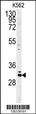 C2orf49 Antibody