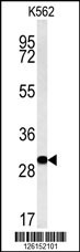 C3orf75 Antibody