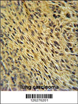 CCDC62 Antibody