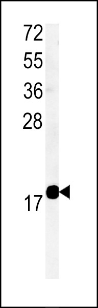 TMEM222 Antibody