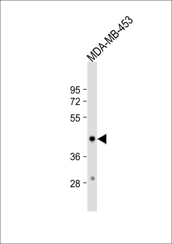 HSD17B2 Antibody