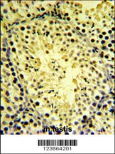 DGKK Antibody