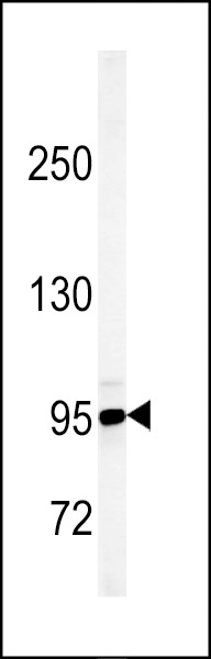 KDM7A Antibody