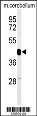 SGTB Antibody