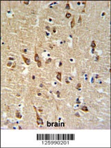 SGTB Antibody