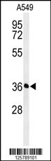 PAAF1 Antibody
