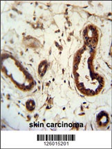 KRT82 Antibody