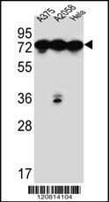 HSPA5 Antibody
