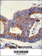 HSPA5 Antibody