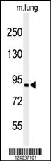 H6PD Antibody