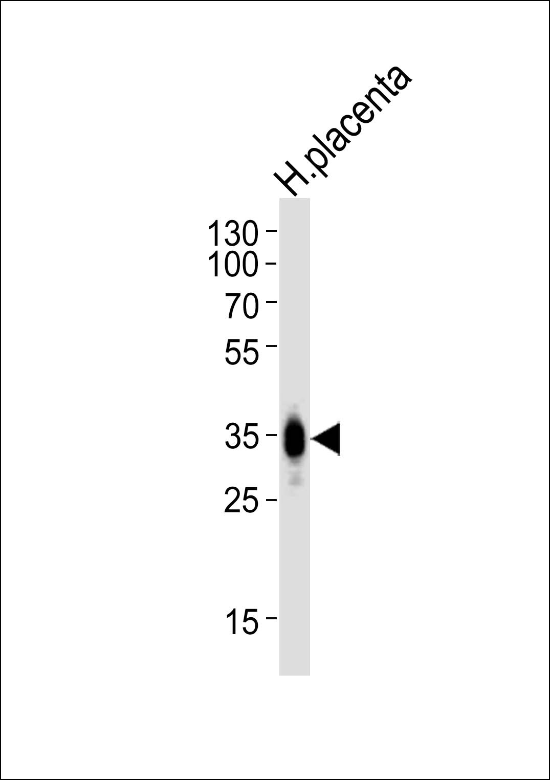 FOLR2 Antibody