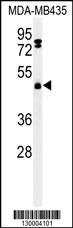 FBXL2 Antibody