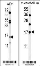 TPPP3 Antibody