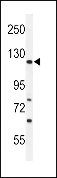 ARHGAP30 Antibody