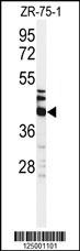 KRT35 Antibody