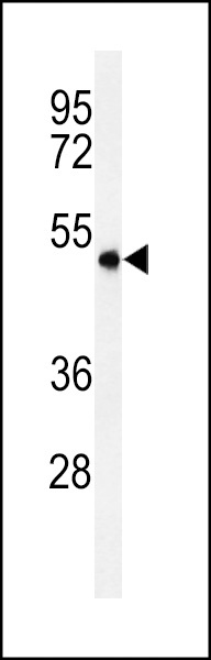 SMPDL3A Antibody