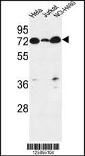 LPPR4 Antibody