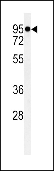TMEM57 Antibody