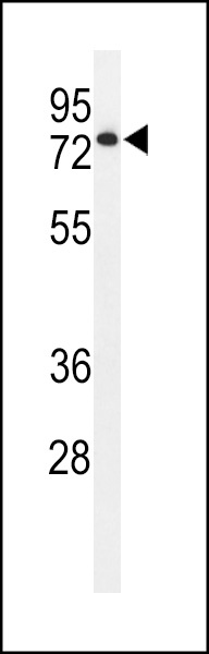 ENPP7 Antibody