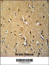 TNFRSF8 Antibody