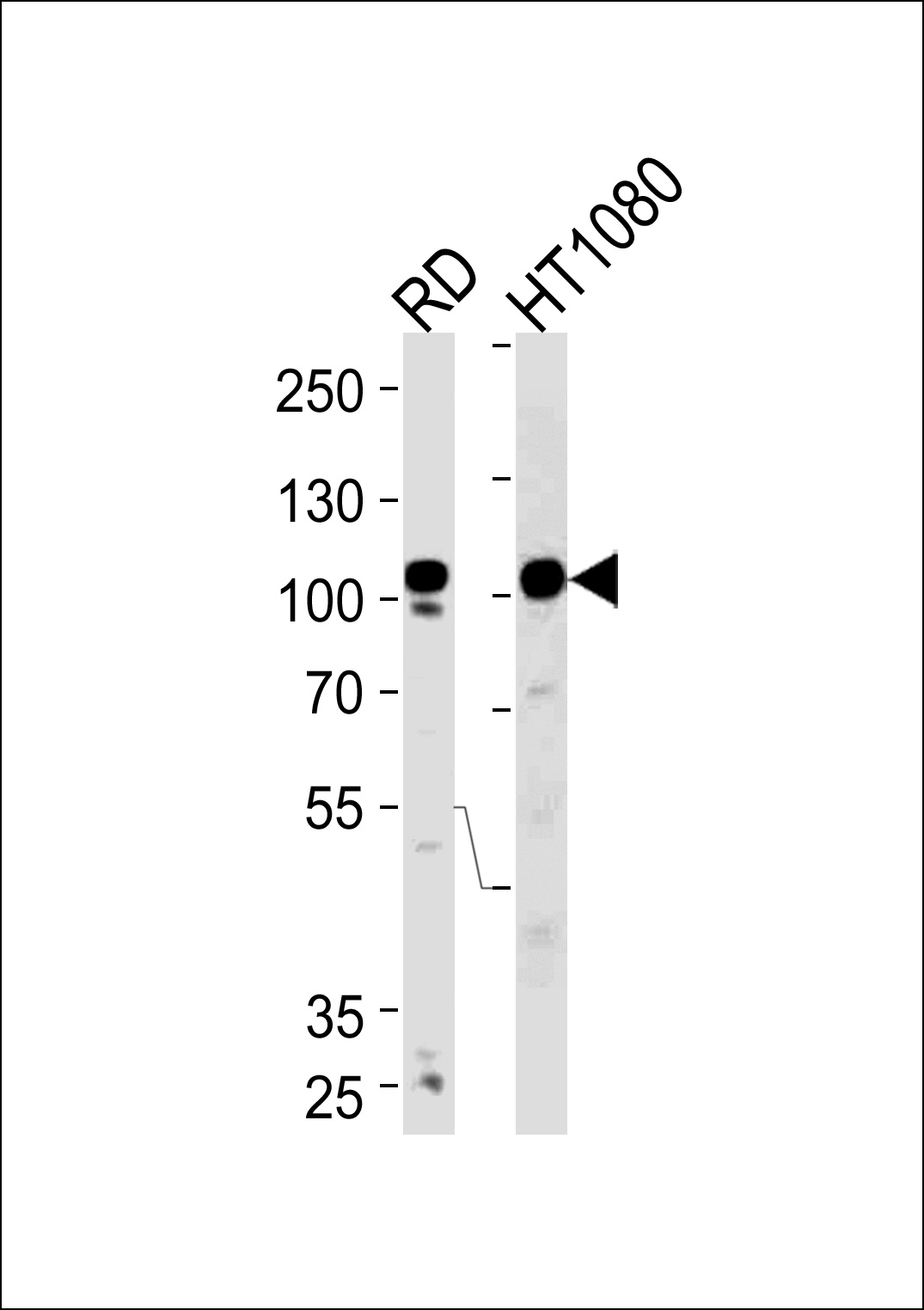 ATP2A1 Antibody