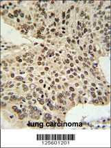 HIST1H2AG Antibody