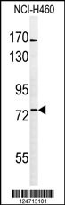 BBS10 Antibody