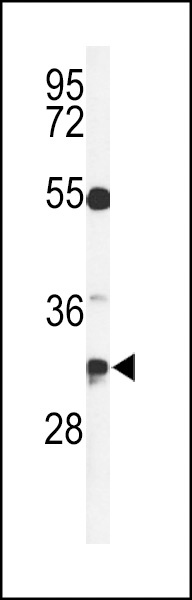 TSPAN7 Antibody