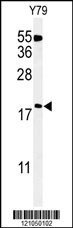 TXNDC12 Antibody