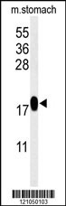 TXNDC12 Antibody