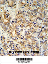TXNDC12 Antibody