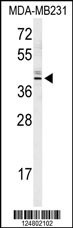KLDC2 Antibody