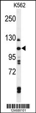 TELO2 Antibody