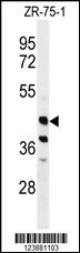 FA2H Antibody