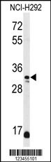 DDO Antibody