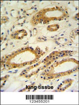 DDO Antibody