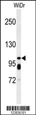 ABCC11 Antibody
