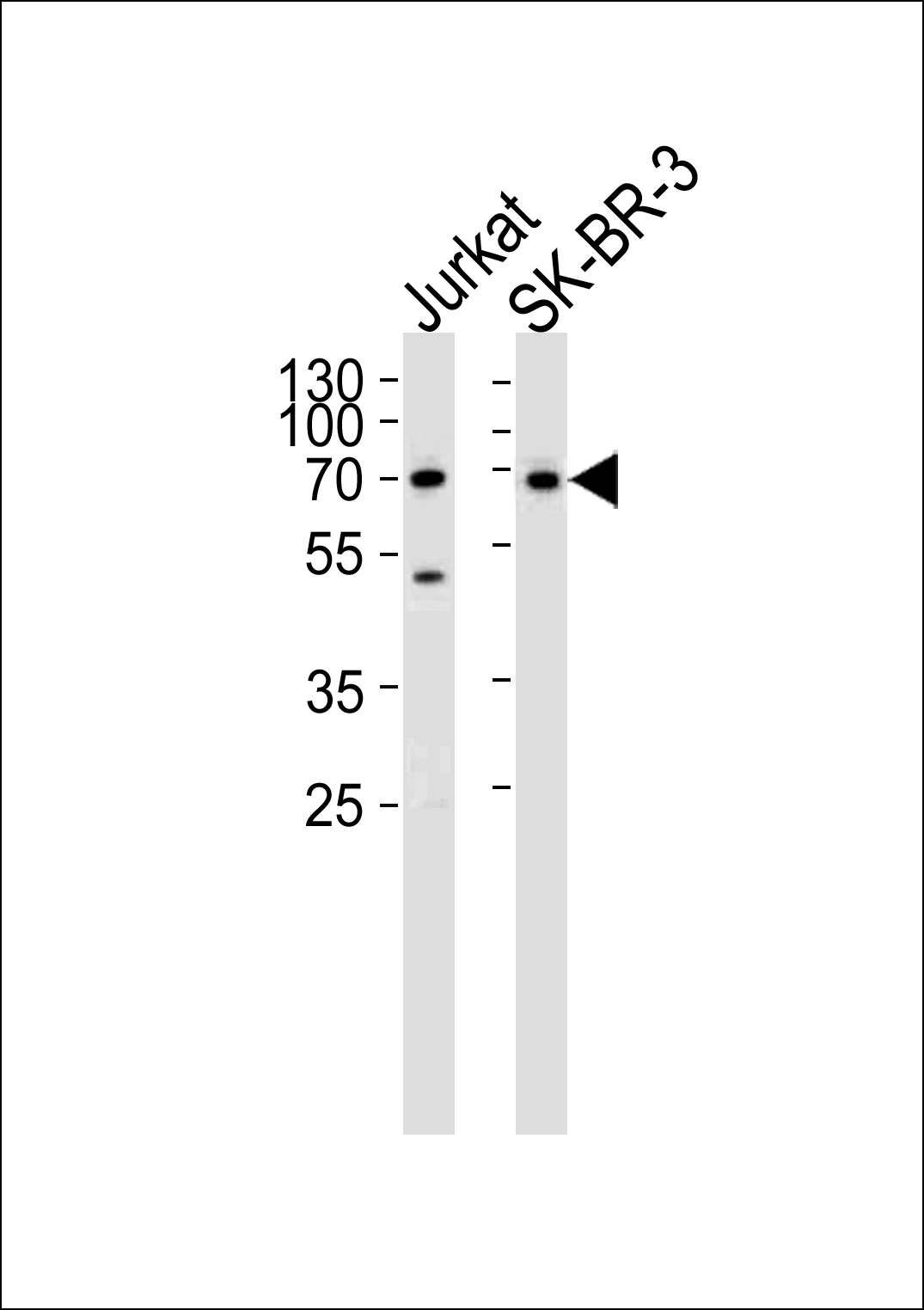 CD46 Antibody