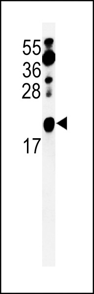 ZNF9 Antibody