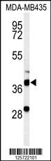 DHRS7 Antibody