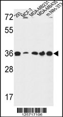 TOR1B Antibody