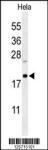 CLEC2B Antibody
