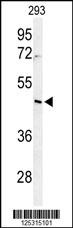 RRS1 Antibody