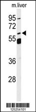 SLC13A5 Antibody
