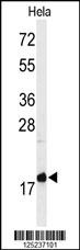 MMGT1 Antibody