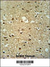 MMGT1 Antibody
